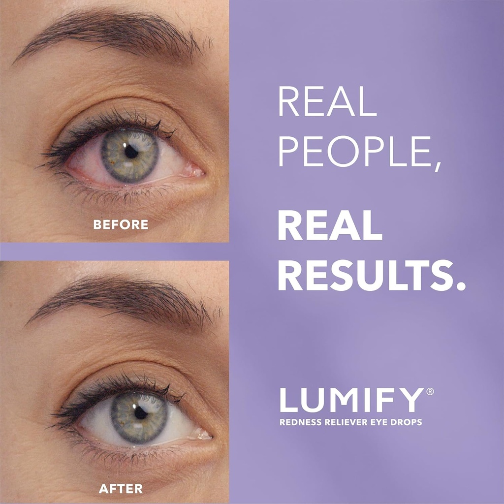 lumify-eye-drops-for-red-eyes-redness-re-2.jpg