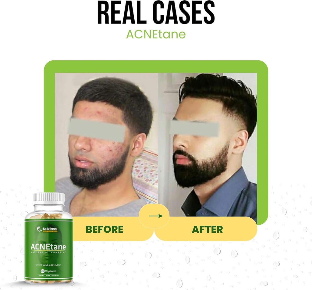acnetane---all-natural-vitamin-supplemen-4.jpg