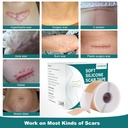 silicone-scar-sheets-16x-158-roll-4m-sil-2.jpg