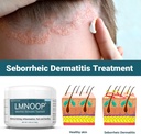seborrheic-dermatitis-cream-extra-streng-2.jpg
