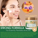green-leaf-naturals-manuka-honey-eczema--3.jpg