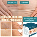 upgrade-silicone-scar-sheets-16-x-120--3-6.jpg