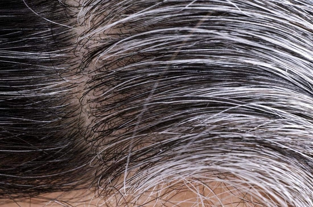hair-loss-for-men---gray-hair-reverse-co-5.jpg
