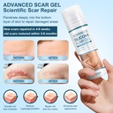 mitgary-advanced-scar-gel-silicone-scar--3.jpg