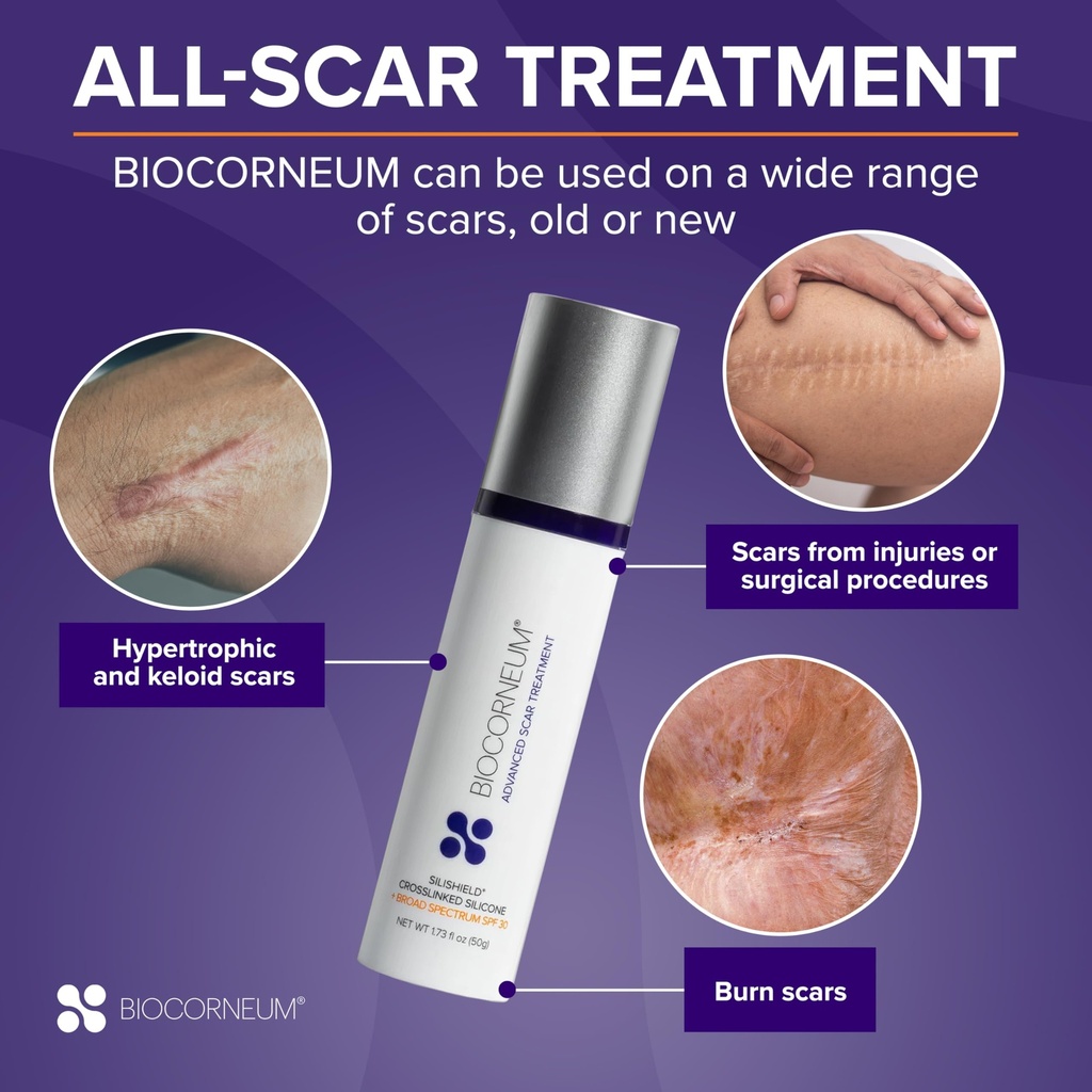 biocorneum-advanced-scar-treatment-with--5.jpg
