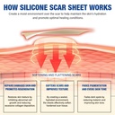 silicone-scar-sheets-silicone-scar-tape--4.jpg