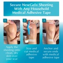 advanced-silicone-scar-treatment-sheets--2.jpg