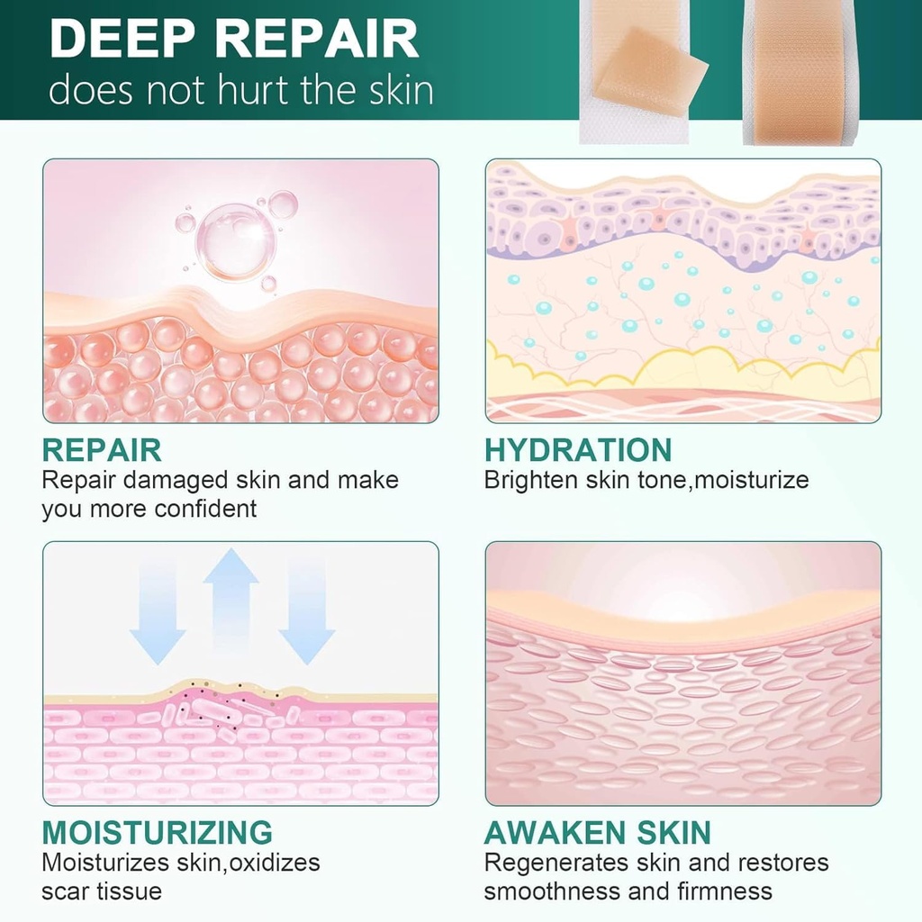 silicone-scar-sheets-silicone-scar-tape--6.jpg