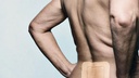 silicone-foam-dressing-with-adhesive-bor-6.jpg