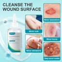 winner-sterile-saline-wipes-dimora-skin--5.jpg