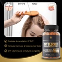 dht-blocker-gummies-hair-growth-suppleme-5.jpg