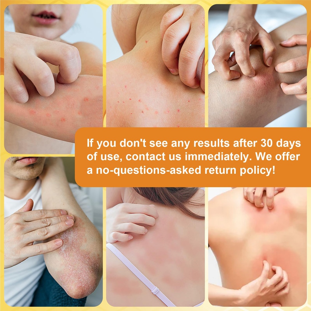 manuka-honey-eczema-soothing-cream-organ-4.jpg