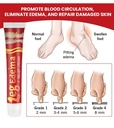 leg-slimming-massage-cream-soothing-swel-4.jpg