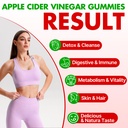 apple-cider-vinegar-gummies-advanced-acv-3.jpg