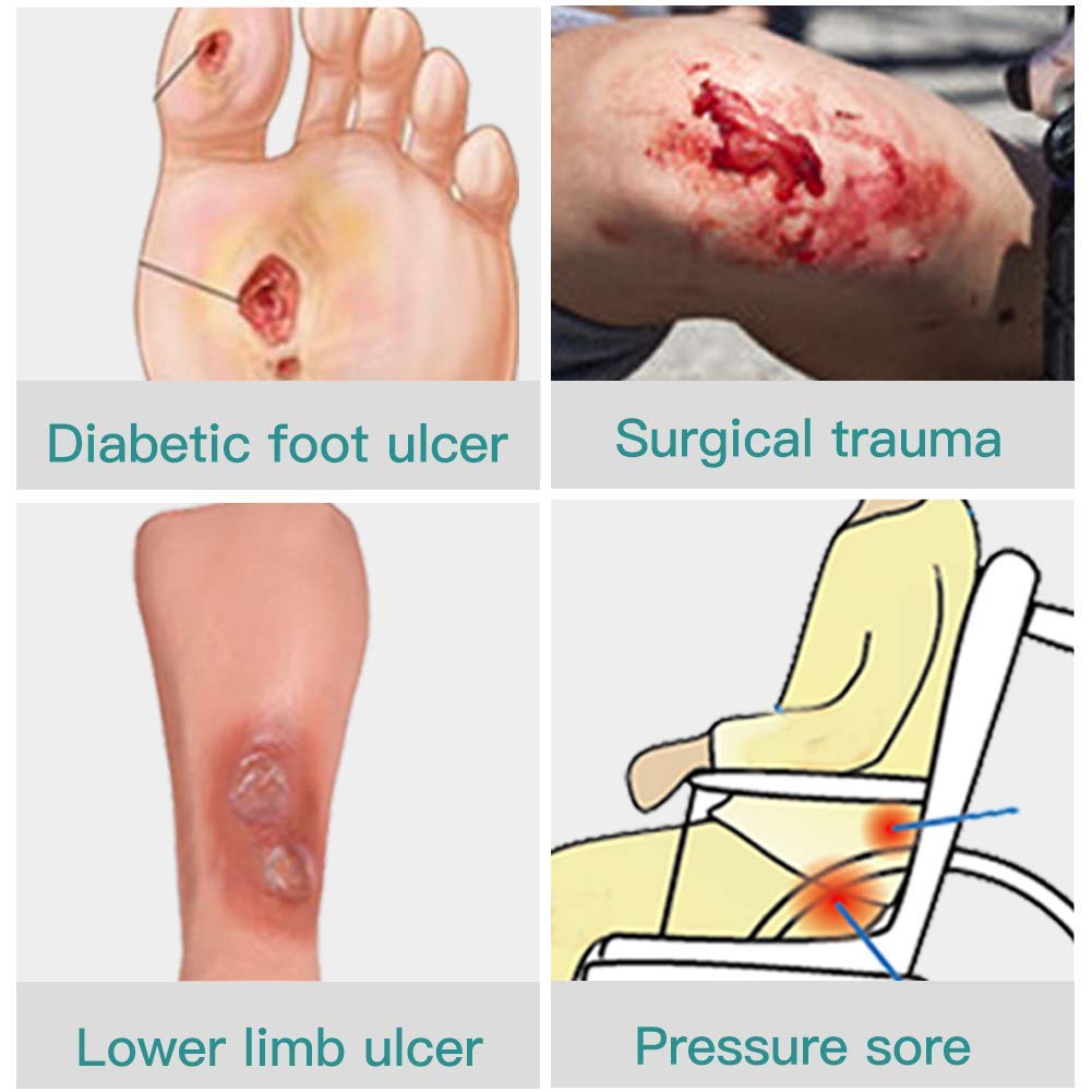 dimora-calcium-alginate-wound-dressing-s-5.jpg