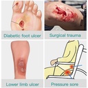 dimora-calcium-alginate-wound-dressing-s-5.jpg