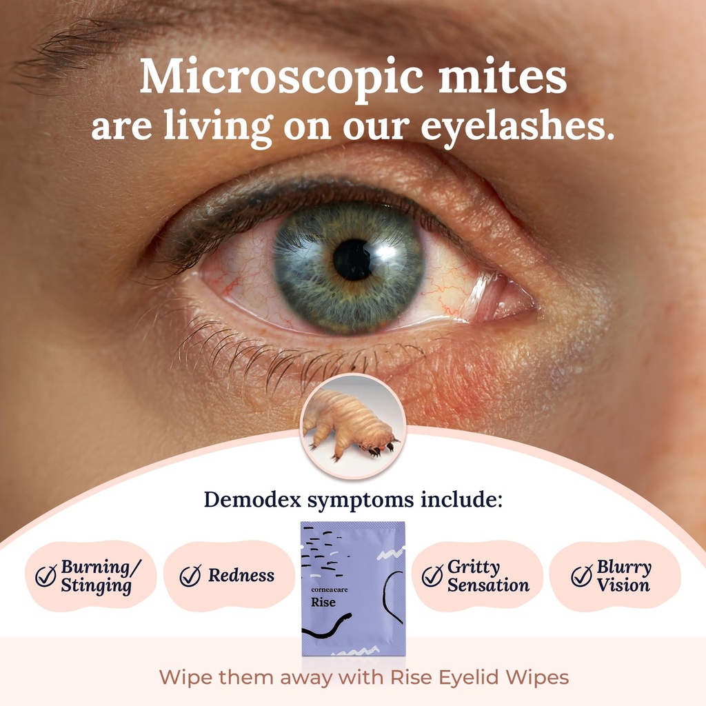 corneacare-rise-eyelid-wipes-eye-wipes-f-3.jpg