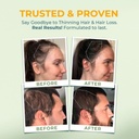 vital-nutritive-vital-hair-complex-bioti-6.jpg