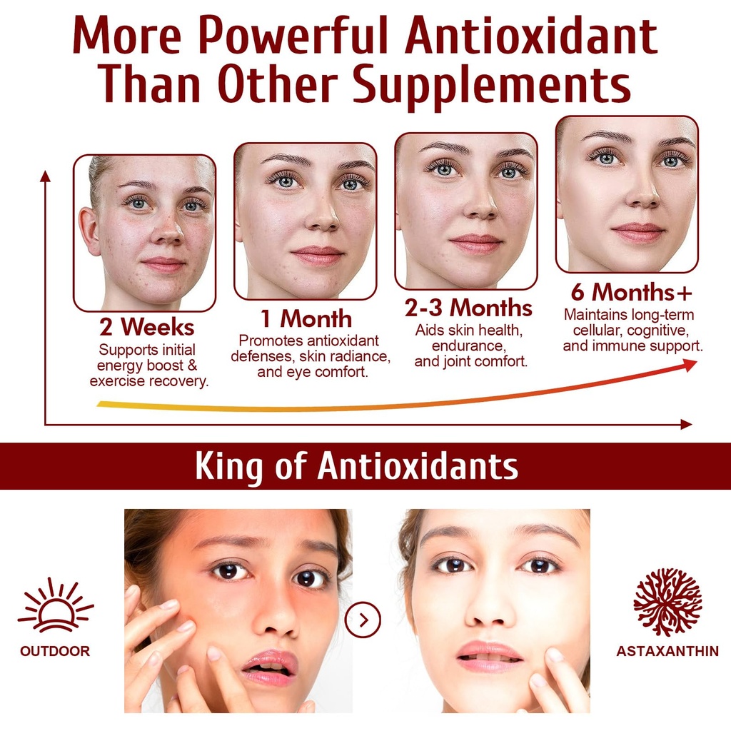 astaxanthin-supplements-12mg-120-softgel-4.jpg