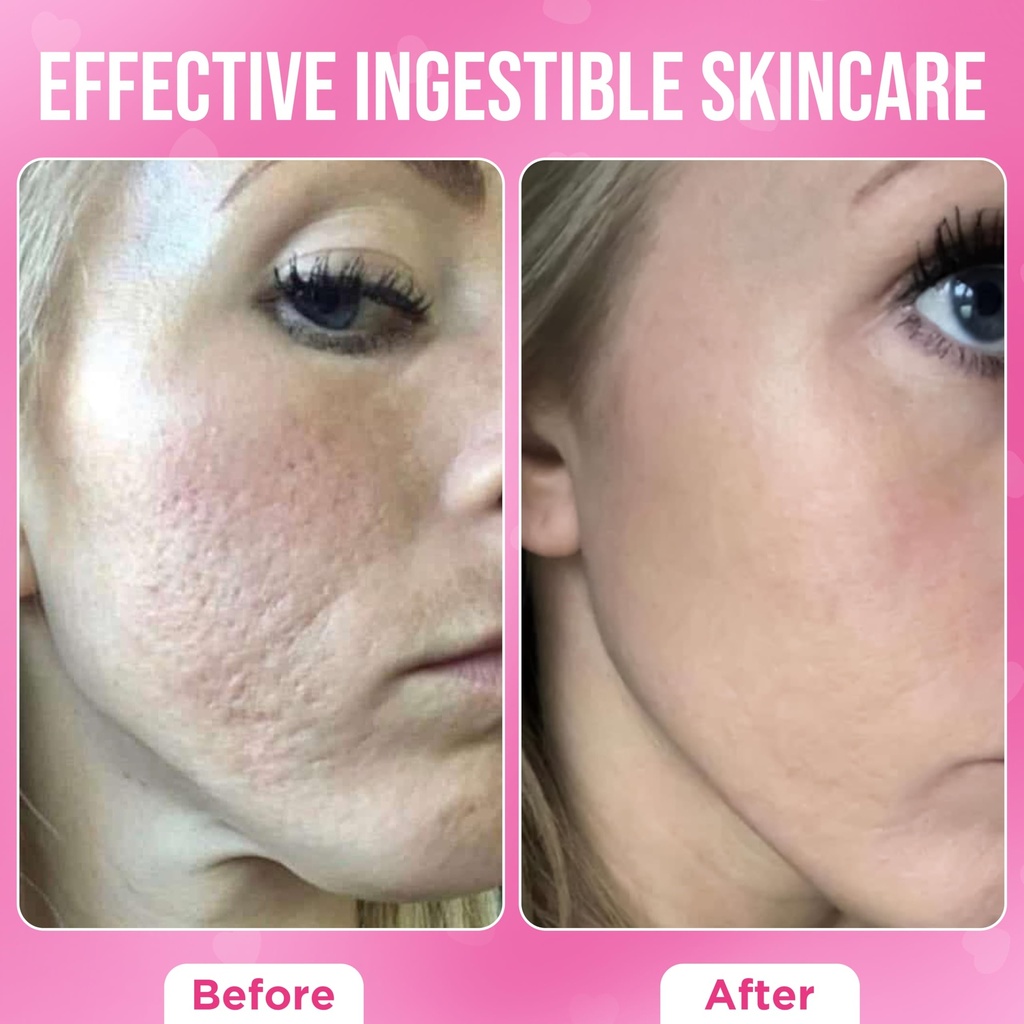 skin-gummies-for-women-teens-beauty-vita-4.jpg