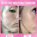 skin-gummies-for-women-teens-beauty-vita-4.jpg