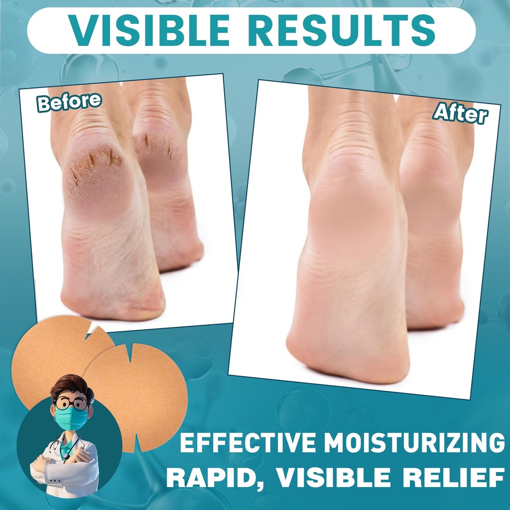 teawoo-30pcs-patented-cracked-heel-treat-3.jpg