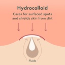 rael-bundle-invisible-spot-cover-pimple--5.jpg