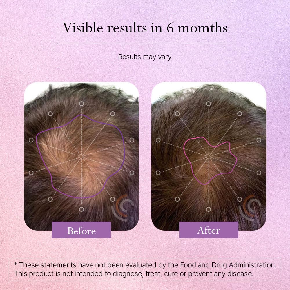 omvi-formulas-hair-growth-supplement-wit-3.jpg