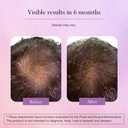 omvi-formulas-hair-growth-supplement-wit-3.jpg