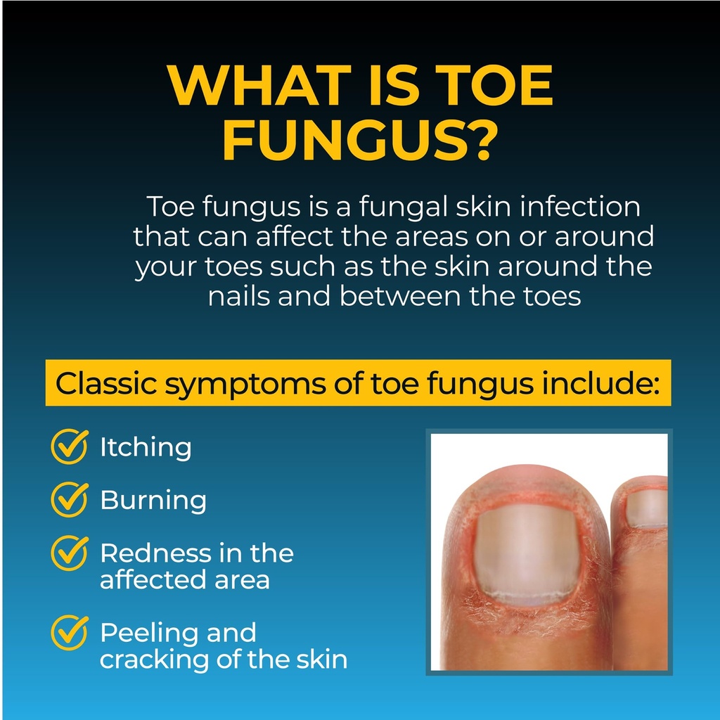 fungi-nail-anti-fungal-liquid-solution-1-4.jpg