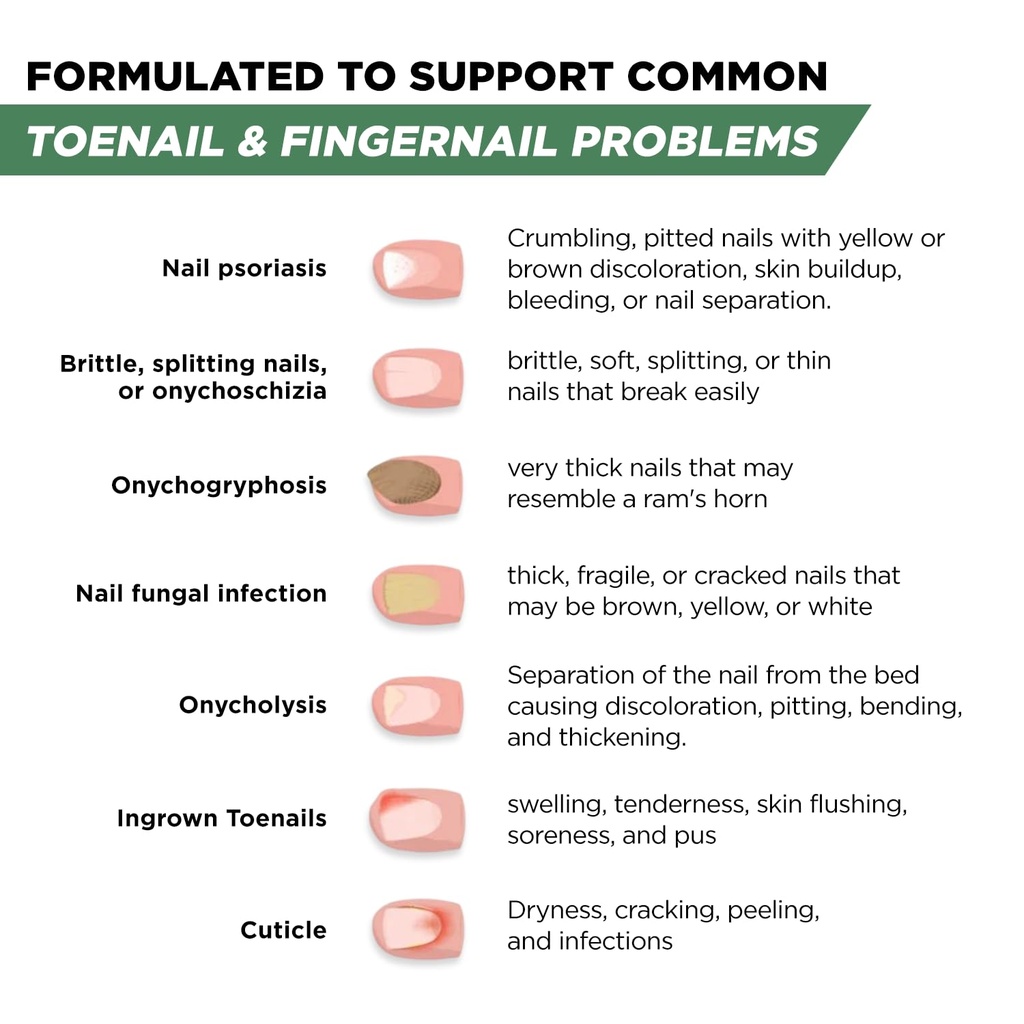 foot-cure-toenail-fungus-treatment-extra-4.jpg