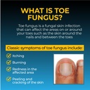 fungi-nail-pen-applicator-anti-fungal-so-5.jpg