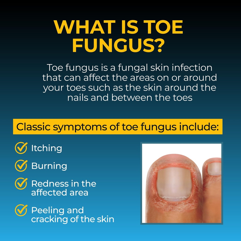 fungi-nail-anti-fungal-foot-spray-kills--5.jpg