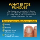 fungi-nail-anti-fungal-foot-spray-kills--5.jpg