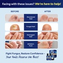toenail-fungus-treatment-with-25-undecyl-3.jpg