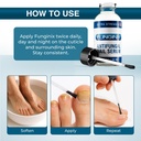 funginix-fungus-treatment-toe-fungus-fin-2.jpg