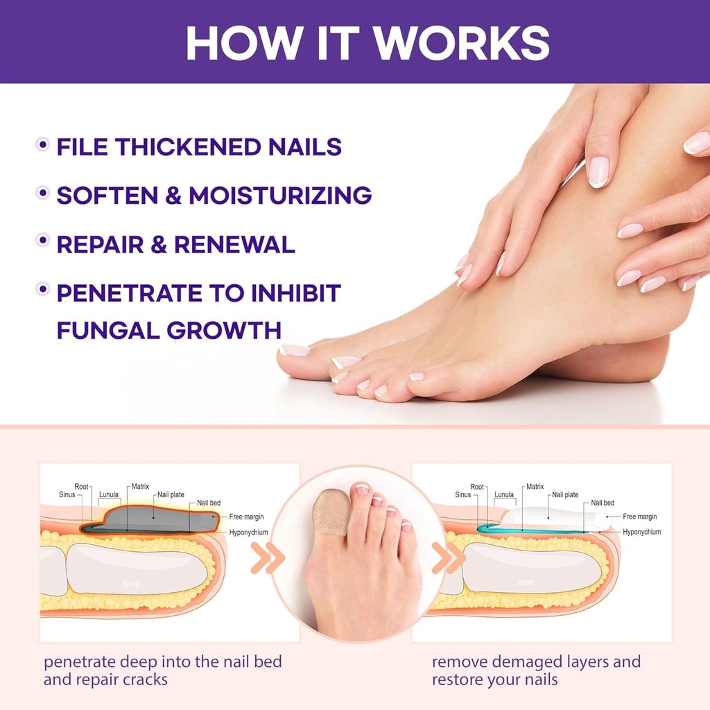 extra-strength-toenail-fungus-treatment--5.jpg