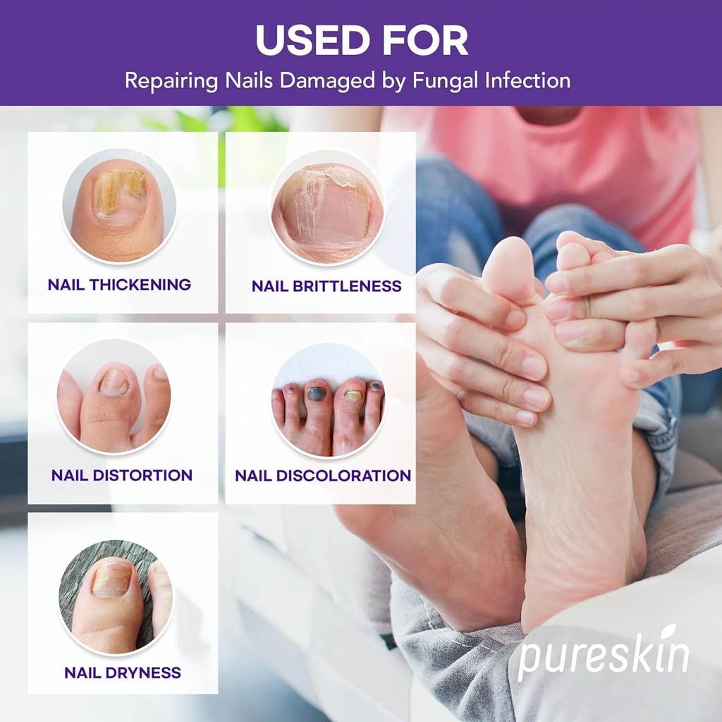 extra-strength-toenail-fungus-treatment--3.jpg