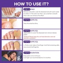 extra-strength-toenail-fungus-treatment--4.jpg