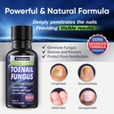 tobcharm-toenail-fungus-treatment-nail-f-2.jpg