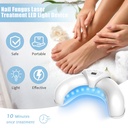 nail-fungus-laser-treatment-led-light-de-2.jpg