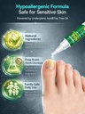 2026-upgrade-toenail-fungus-treatment-gm-6.jpg