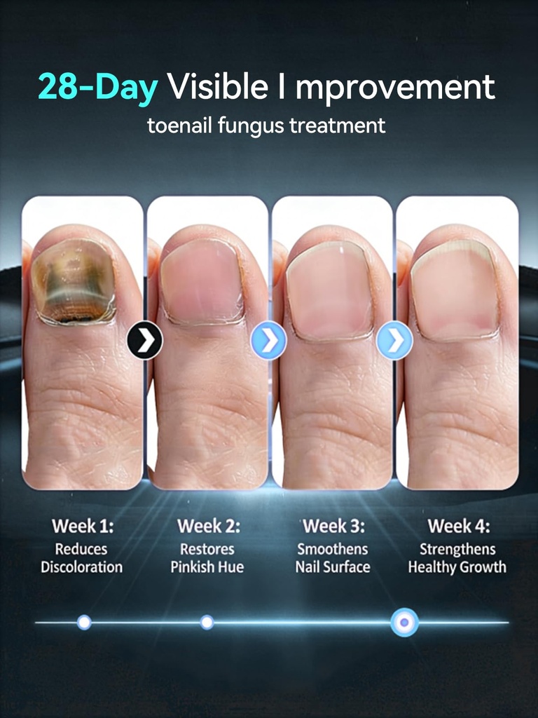 2026-upgrade-toenail-fungus-treatment-gm-4.jpg