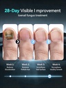2026-upgrade-toenail-fungus-treatment-gm-4.jpg