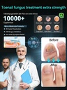 2026-upgrade-toenail-fungus-treatment-gm-3.jpg