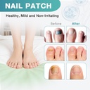 fungal-nail-patches-toenail-fungus-treat-5.jpg