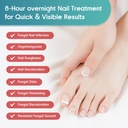 fungal-nail-patches-toenail-fungus-treat-4.jpg
