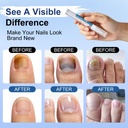 toenail-fungus-treatment-extra-strength--4.jpg