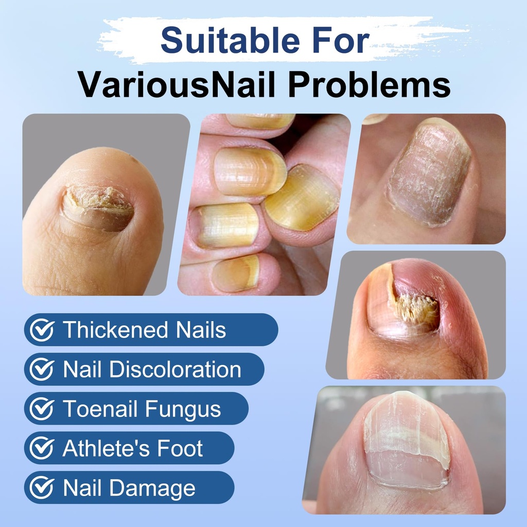 toenail-fungus-treatment-extra-strength--3.jpg