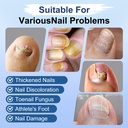 toenail-fungus-treatment-extra-strength--3.jpg